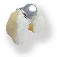 Patello-femoral prosthesis KineMatch®