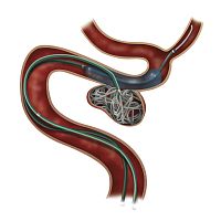 Transseptal access sheath Headway® Duo