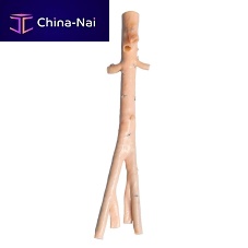 Abdominal aorta vascular bioprosthesis AngioGraft®iliac arteryallograft