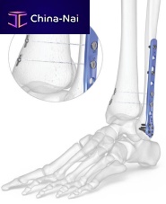 Tibia compression plate 7007-0 seriesfibulaankledistal