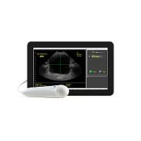 Hand-held bladder scanner ViewBladder 10