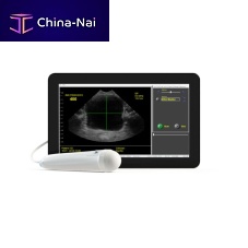 Hand-held bladder scanner ViewBladder 10