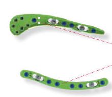 Clavicle compression plate CBTGLN1lateralmediallocking