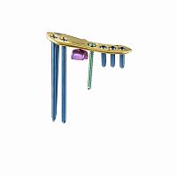 Tibia osteotomy plate LCfit®mediallockingmetallic