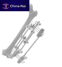 Femur external fixation system 201503tubularadult