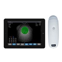 Hand-held bladder scanner BS2
