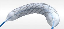 Coronary stent DESyne®cobalt-chromiumdrug eluting