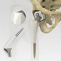 Primary hip prosthesis 7022-4 seriescementless