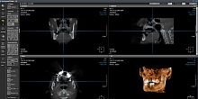 Medical software ONDEMAND3Dsurgerydentalendoscopy