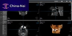 Medical software ONDEMAND3Dsurgerydentalendoscopy