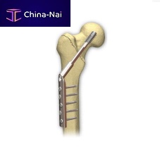 Femoral head compression plate lockingmetallic