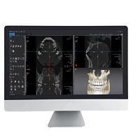 CT software Dentiq 3Dfor dental imagingdentalanalysis