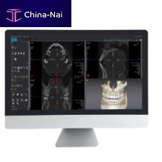 CT software Dentiq 3Dfor dental imagingdentalanalysis