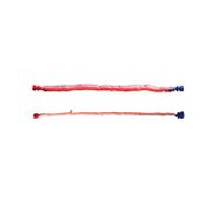 Pulmonary artery vascular bioprosthesis CryoVein® PCallograftpediatric