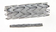 Coronary arteries stent graft Prograft