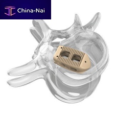Lumbar interbody fusion cage 4000 seriesposteriorPEEK