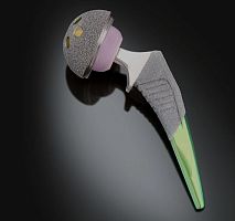 Minimally invasive hip prosthesis Spartan cementless