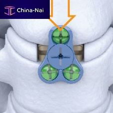 Cervical interbody fusion cage Carmen®lateral
