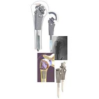 Cementless shoulder prosthesis JUST UNIC®