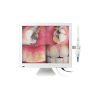 Intraoral camera M-978VdigitalCMOS