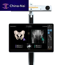 Hip prosthesis positioning surgical navigation system RIoptical