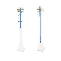 Humeral intramedullary nail QMLrightlefttitanium