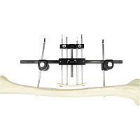 Femur external fixation system tubularadult