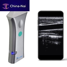 Hand-held ultrasound system SIFULTRAS-3.54for urology ultrasound imagingfor breast ultrasound imagingB/W