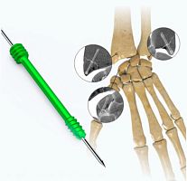 Hand compression bone screw cannulated