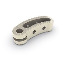 Thoraco-lumbar interbody fusion cage twin peaks TLIFtransforaminalPEEK