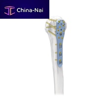 Humerus compression plate PNM1004proximallockingmetallic
