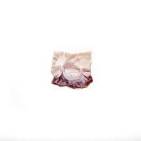 Pulmonary artery vascular bioprosthesis CardioGraft® Monoallograftwith valve