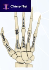 Hand phalange compression plate FRC seriesmetacarpal jointlockingmetallic