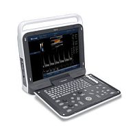 Portable ultrasound system iMage T6for gynecological and obstetric ultrasound imagingfor cardiovascular ultrasound imagingfor abdominal and pelvic ultrasound imaging