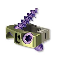 Cervical interbody fusion cage 8.6970.505anteriorPEEKtitanium