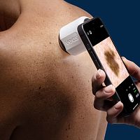 White LED dermatoscope proVEOS®