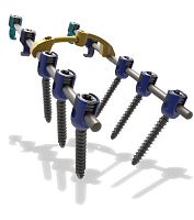 Cervico-thoracic osteosynthesis unit Blackbirdposterioradult