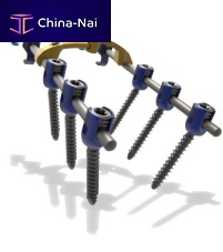 Cervico-thoracic osteosynthesis unit Blackbirdposterioradult