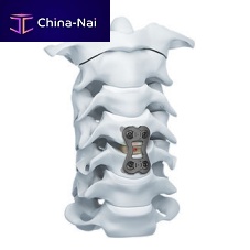 Cervical arthrodesis plate CAP 1 level