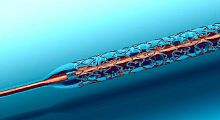 Coronary stent I-SYNCpolymer