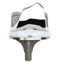 Total knee prosthesis ANTHEMfixed-bearingcemented