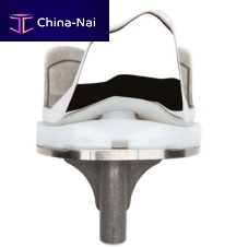Total knee prosthesis ANTHEMfixed-bearingcemented