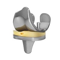 Total knee prosthesis EMPOWR 3D®fixed-bearingcemented