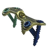 Metatarsal bone osteotomy plate HJ-VA-LOC 03forefootmediallocking