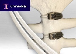 Sternal closure bone cerclage wiring SuperCable® Iso-Elasticmultifilament polymer