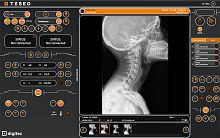 Anatomical imaging software TESEO for orthopedic imagingradiographydiagnostic