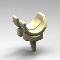 Temporary knee spacer OGMKS series