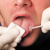 Buccal cytology brush OralCDx®single use