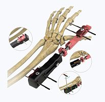 Wrist external fixation system 5508-0000 tubularadult