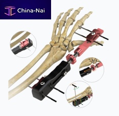 Wrist external fixation system 5508-0000 tubularadult